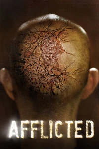 Sức Mạnh Dị Thường - Afflicted (2014)